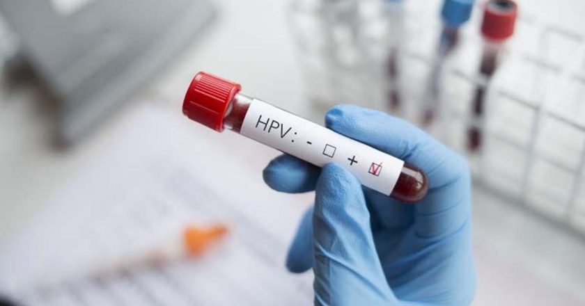 “HPV'nin kansere neden olan türleri var, etmeyen türleri de var”
