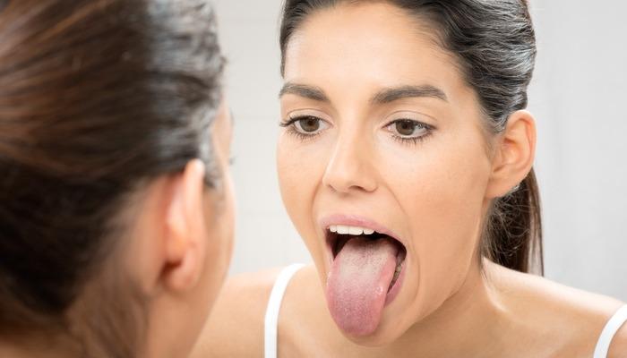 Ağzınız sinyal veriyor: Dilinizdeki bu renklere dikkat edin!  Kanser veya şeker hastalığının belirtisi olabilir