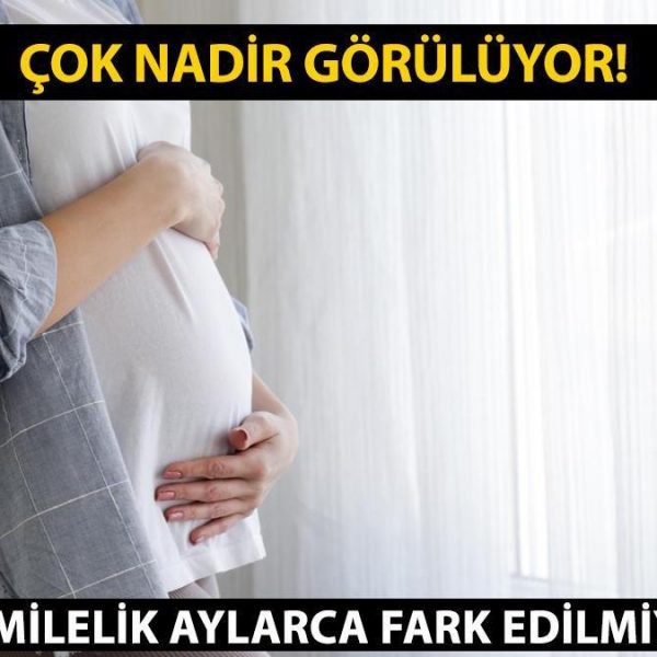 Kriptik gebelik nedir, ne anlama gelir? Kriptik hamileliğin nedenleri ve belirtileri nelerdir?